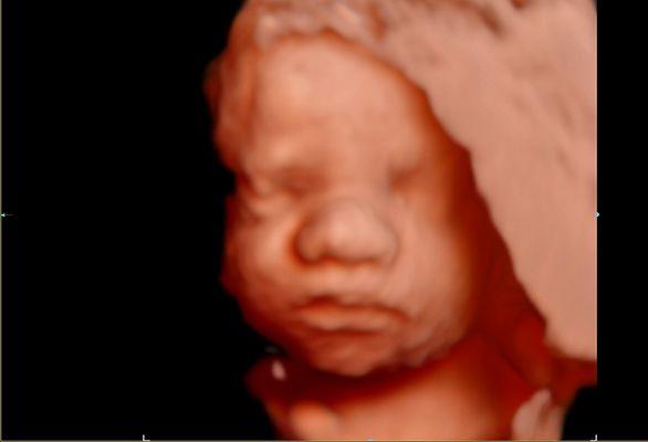 Hello Baby 4D Ultrasound Studio