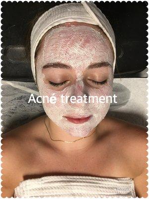 Acne treatment mask