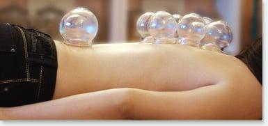 Cupping