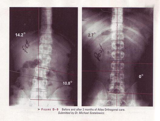 Atlas Chiropractic Office