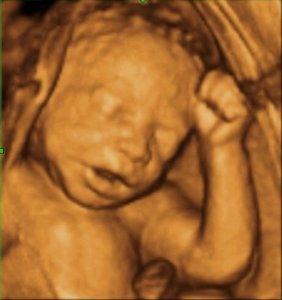 3D Ultrasound in houston tx showing 3D Ultrasound 27 weeks