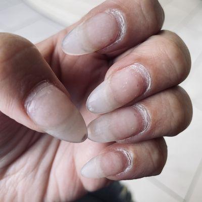 Dead skin on cuticles