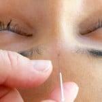 Acupuncture is an ancient modality using a very fine needle that is inserted into acupuncture points.