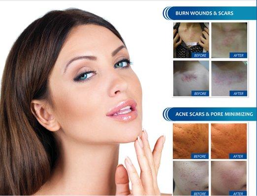 Laser Hair Removal And Aesthetic Center