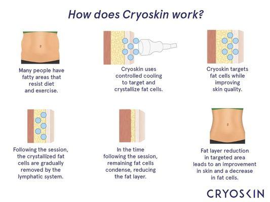 How does Cryoskin work?