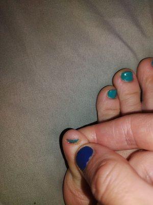 My pinkie toe cut too low and cut near the cuticle after a pedicure.