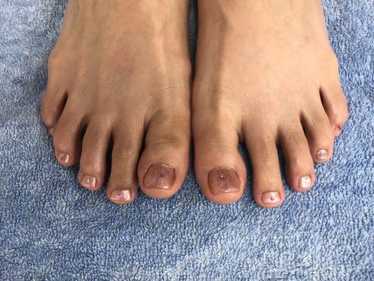 Matching pedicure with refreshed feet!!