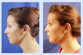 Florida Ear Nose Throat & Facial Plastic Surgery Center