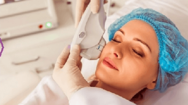 Laser Skin Treatment