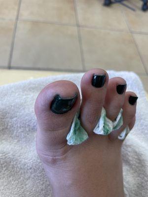 Toe nails unshaped and color outside the lines