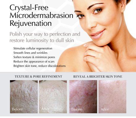 Diamond Micro Dermabrasion