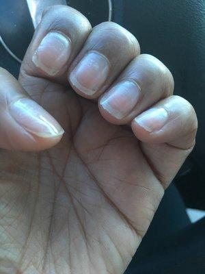 Look at the ragged shape my nails were filed in..sigh