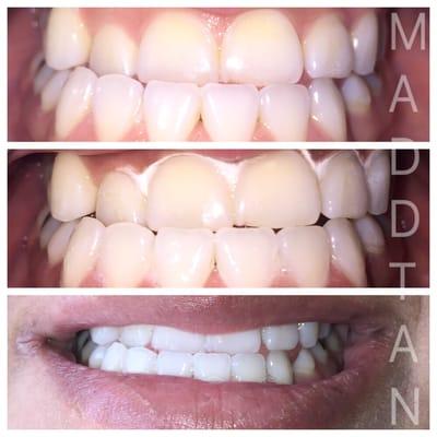 1hr plant and mineral based whitening!