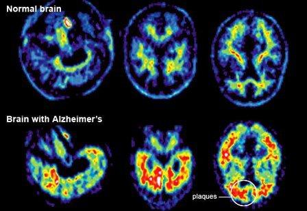 Trident PET/CT of Savannah