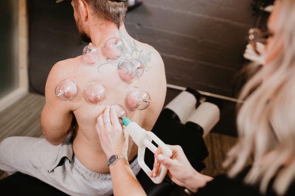 Cupping