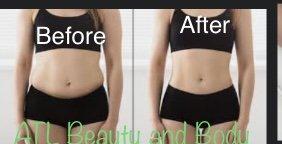 Awesome results no downtime !