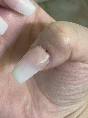 Lifting and cut in the cuticle