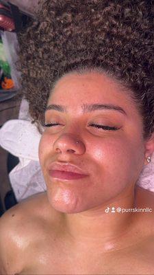 Dermaplaning facial