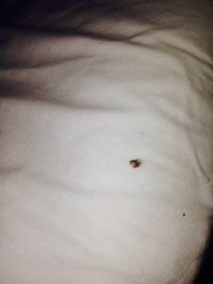 Bed bugs