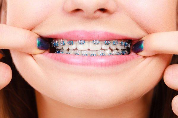 ORTHODONTICS / ORTODONCIA.