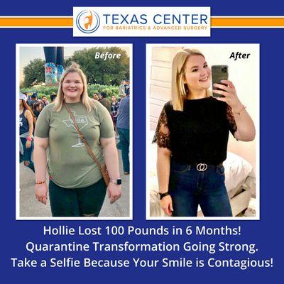 Want to look as good as Hollie?  Hollie lost 100 pounds with the help of weight loss surgery.  One Operation Can Change Your Life.