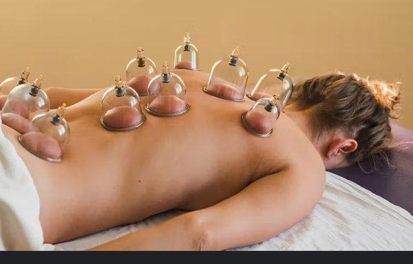 Cupping Therapy