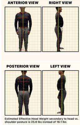 Posture analysis